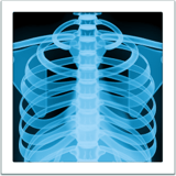 X Ray